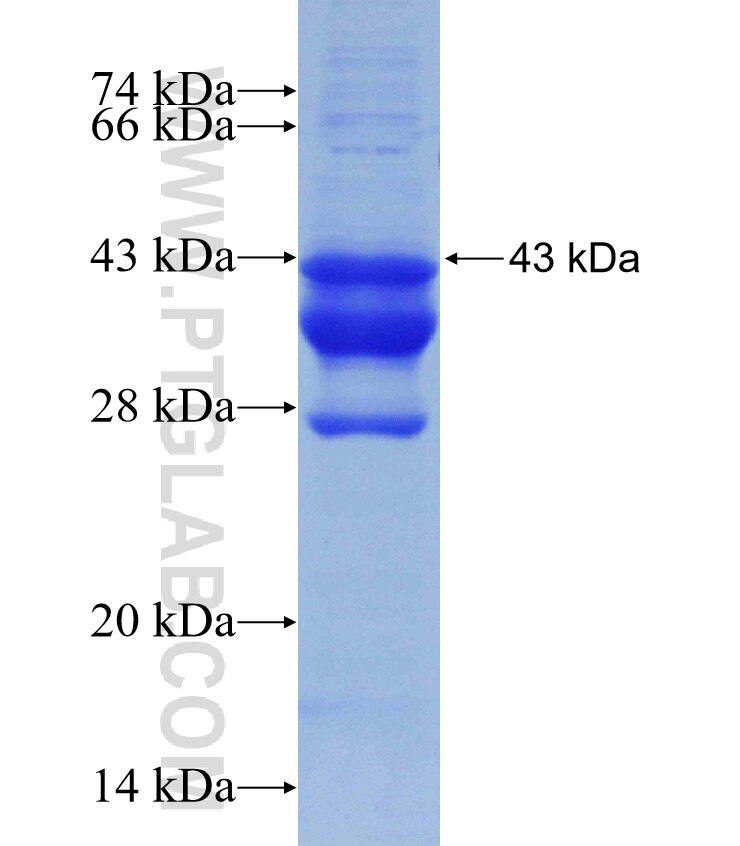 ZBTB7A fusion protein Ag31077 SDS-PAGE