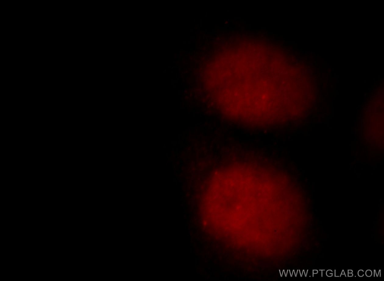 Immunofluorescence (IF) / fluorescent staining of MCF-7 cells using ZBTB7B Polyclonal antibody (11341-1-AP)