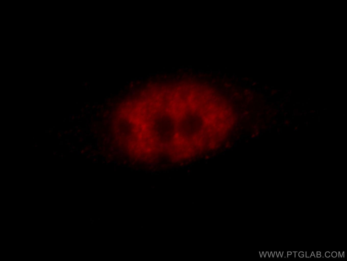 Immunofluorescence (IF) / fluorescent staining of HeLa cells using ZBTB7B Polyclonal antibody (11341-1-AP)
