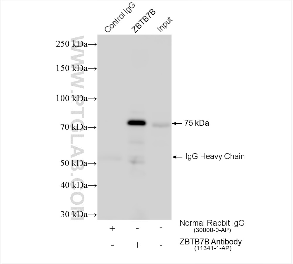 Immunoprecipitation (IP) experiment of HeLa cells using ZBTB7B Polyclonal antibody (11341-1-AP)