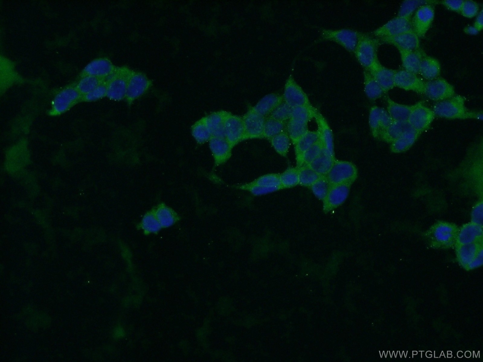 Immunofluorescence (IF) / fluorescent staining of HEK-293 cells using ZBTB8A Polyclonal antibody (24544-1-AP)