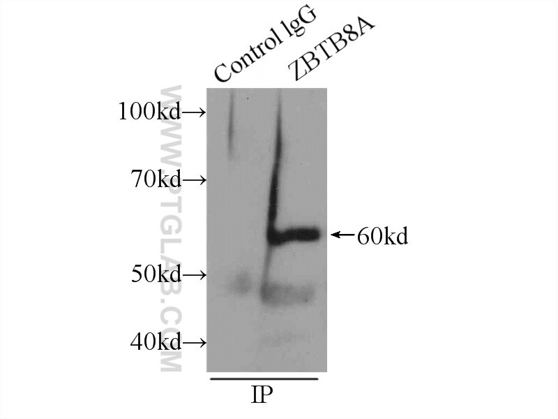 Immunoprecipitation (IP) experiment of HEK-293 cells using ZBTB8A Polyclonal antibody (24544-1-AP)