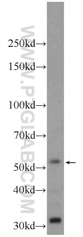 Western Blot (WB) analysis of HEK-293 cells using ZBTB8A Polyclonal antibody (24544-1-AP)