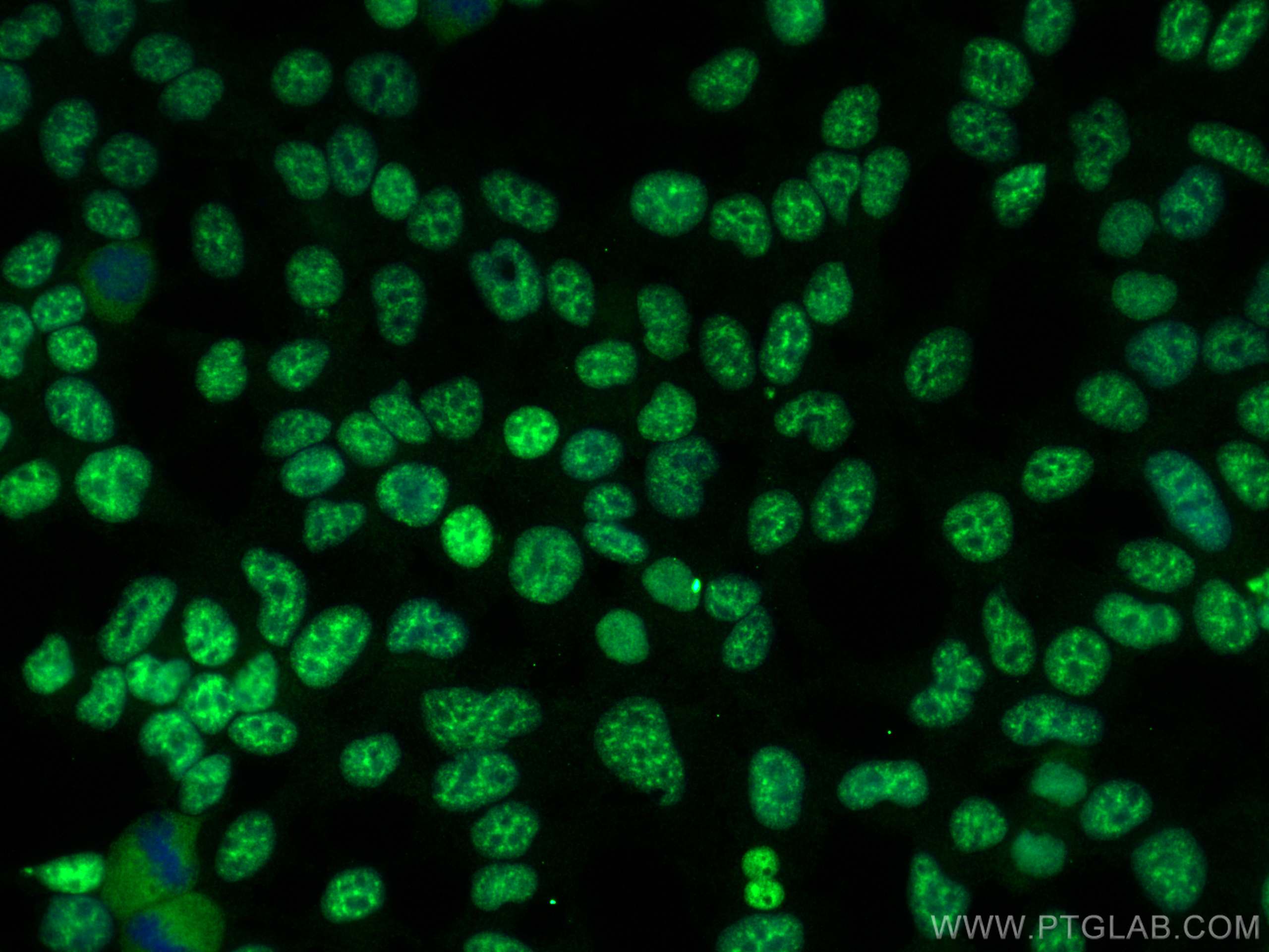 Immunofluorescence (IF) / fluorescent staining of HEK-293 cells using ZC3H11A Polyclonal antibody (26081-1-AP)