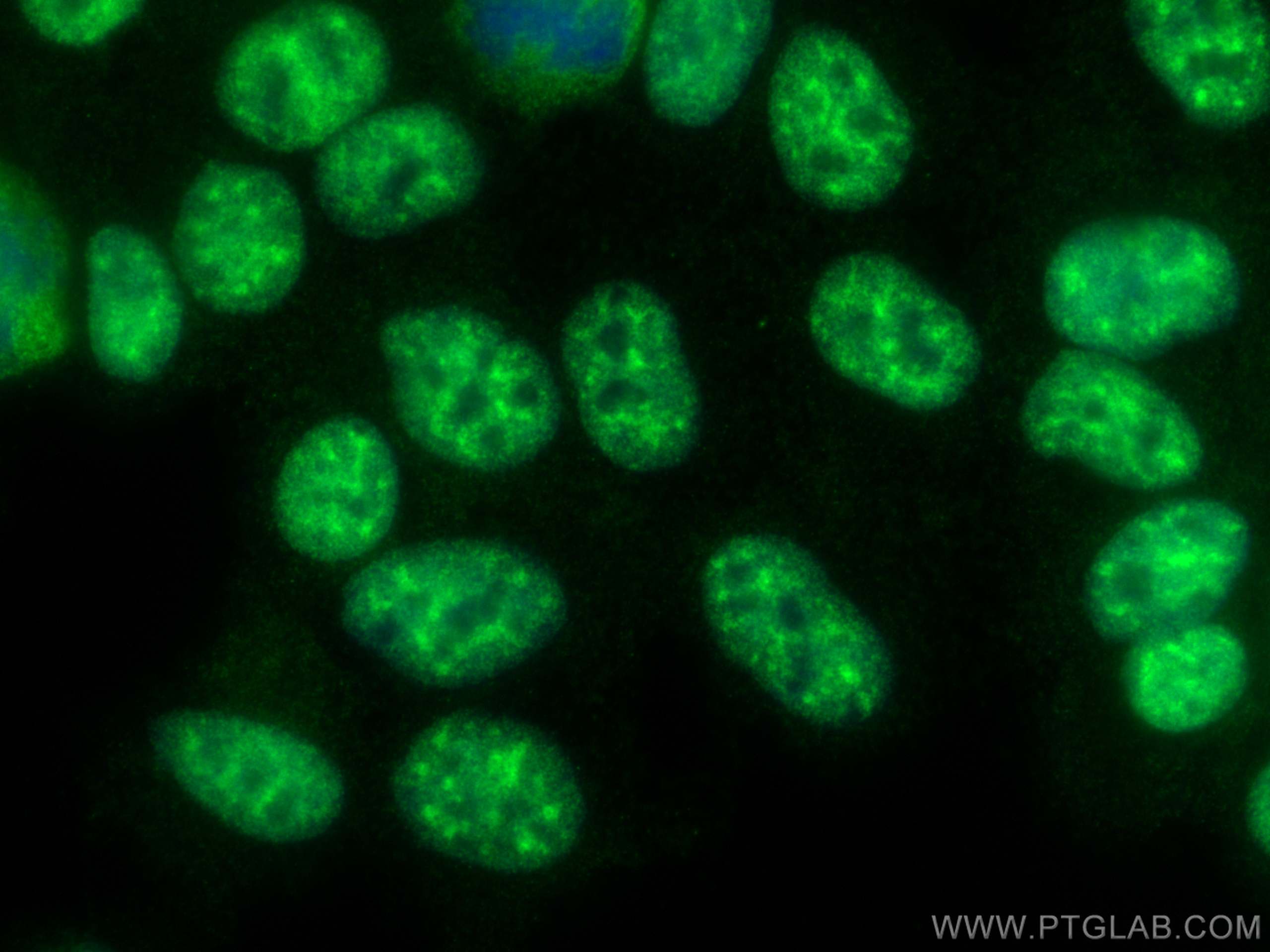 Immunofluorescence (IF) / fluorescent staining of HEK-293 cells using ZC3H11A Polyclonal antibody (26081-1-AP)