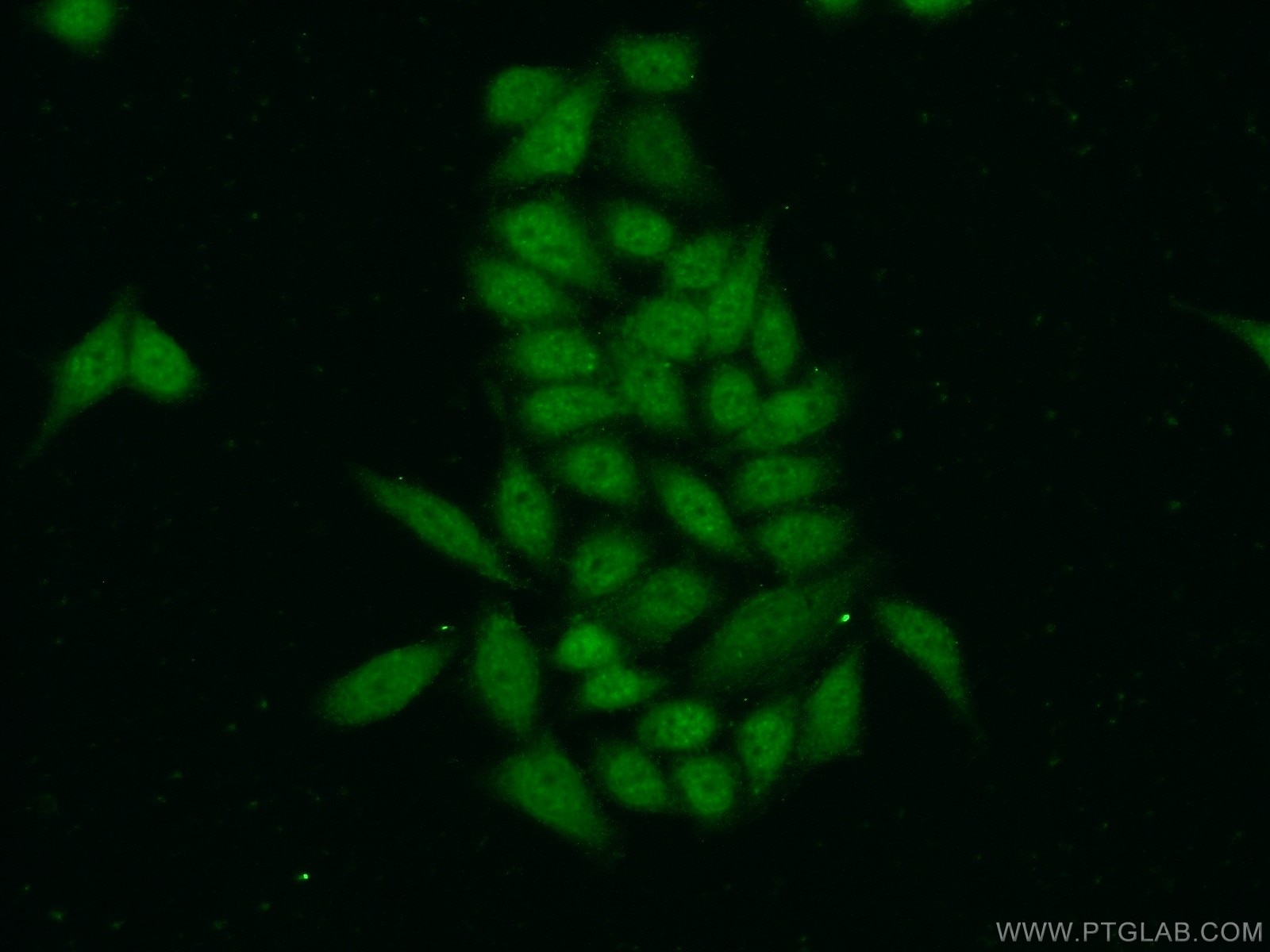 Immunofluorescence (IF) / fluorescent staining of HeLa cells using ZC3H11A Polyclonal antibody (26081-1-AP)