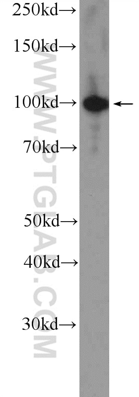 Western Blot (WB) analysis of HeLa cells using ZC3H11A Polyclonal antibody (26081-1-AP)