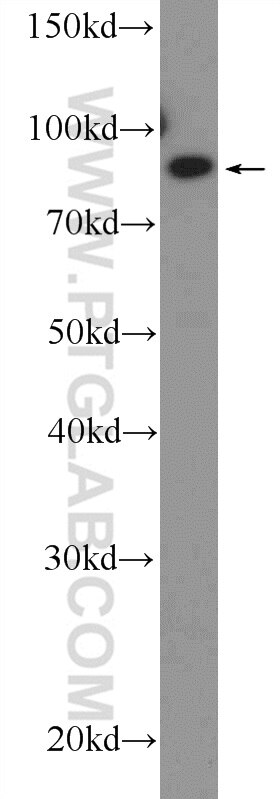 Western Blot (WB) analysis of mouse ovary tissue using ZC3H11A Polyclonal antibody (26081-1-AP)