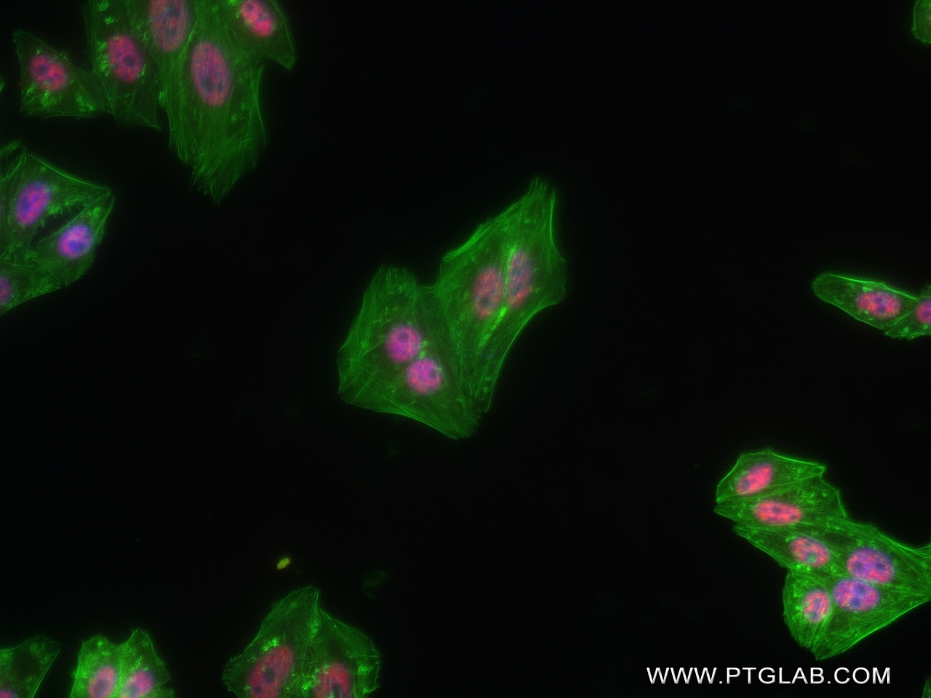 Immunofluorescence (IF) / fluorescent staining of HepG2 cells using ZC3H11A Recombinant antibody (82912-1-RR)