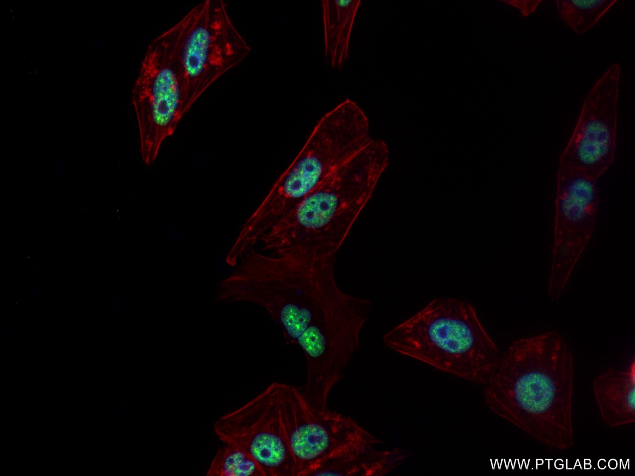 Immunofluorescence (IF) / fluorescent staining of HepG2 cells using ZC3H11A Recombinant antibody (82912-2-RR)
