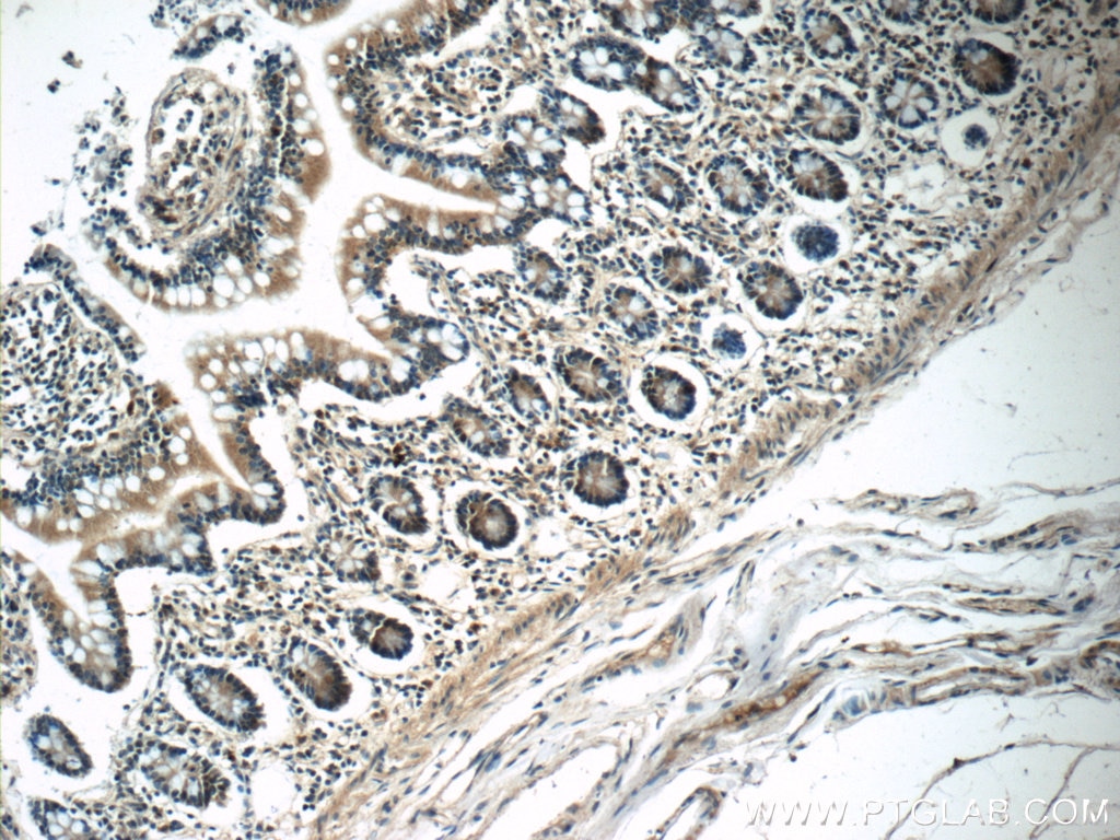 Immunohistochemistry (IHC) staining of human small intestine tissue using ZC3H12A Polyclonal antibody (25009-1-AP)