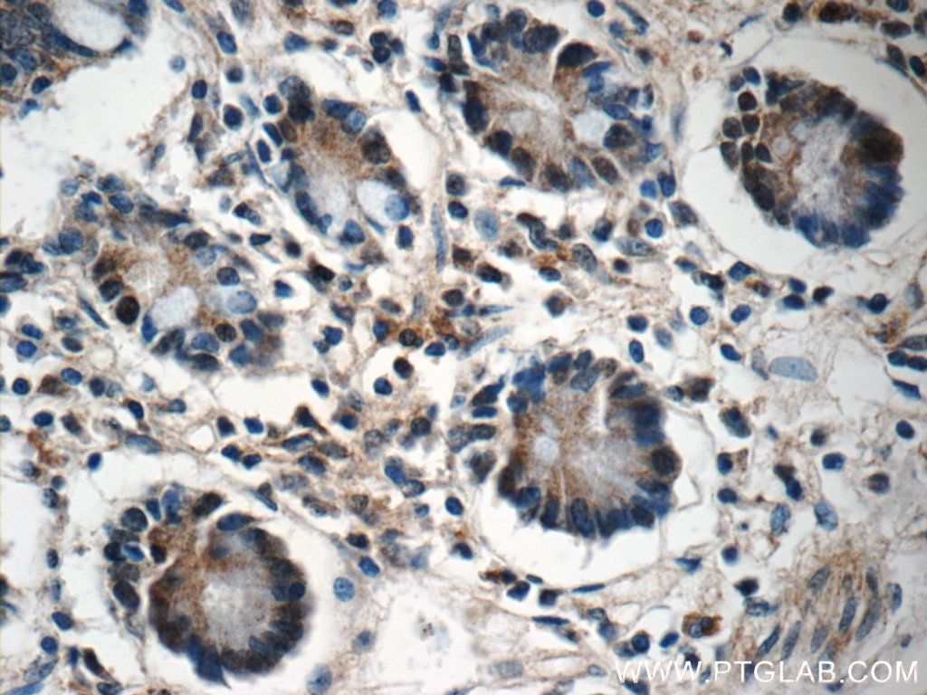 Immunohistochemistry (IHC) staining of human small intestine tissue using ZC3H12A Polyclonal antibody (25009-1-AP)