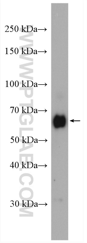 Western Blot (WB) analysis of K-562 cells using ZC3H12A Polyclonal antibody (25009-1-AP)