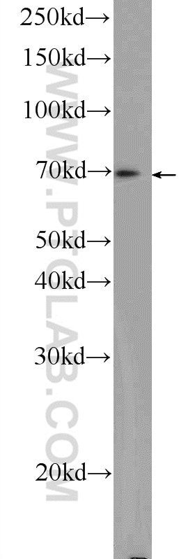 Western Blot (WB) analysis of mouse spleen tissue using ZC3H12A Polyclonal antibody (25009-1-AP)