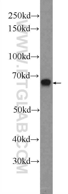 Western Blot (WB) analysis of Raji cells using ZC3H12A Polyclonal antibody (25009-1-AP)