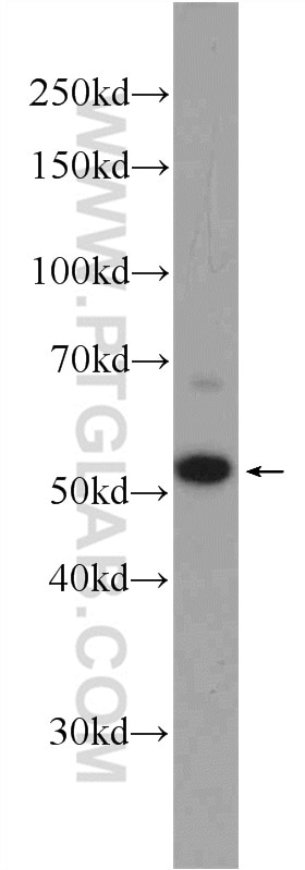 Western Blot (WB) analysis of Raji cells using ZC3H12D Polyclonal antibody (24991-1-AP)