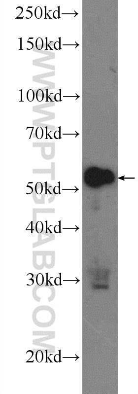 Western Blot (WB) analysis of Raji cells using ZC3H12D Polyclonal antibody (24991-1-AP)