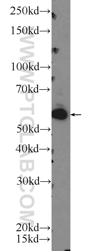 Western Blot (WB) analysis of K-562 cells using ZC3H12D Polyclonal antibody (24991-1-AP)