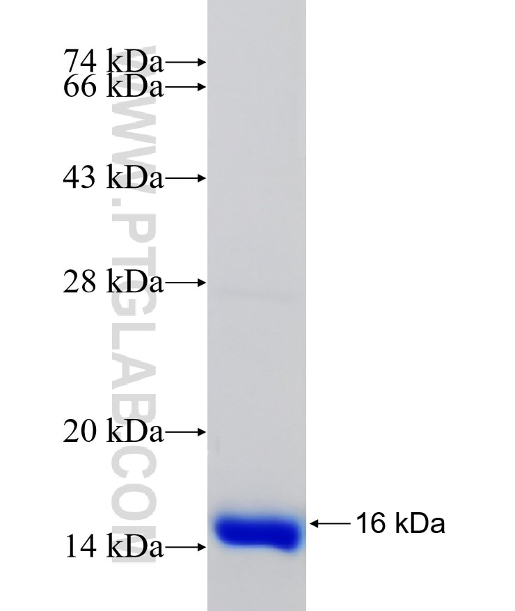 ZC3H12D fusion protein Ag21770 SDS-PAGE