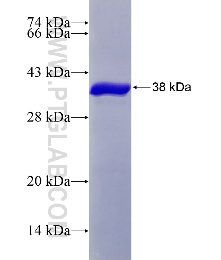 ZC3H13 fusion protein Ag29132 SDS-PAGE