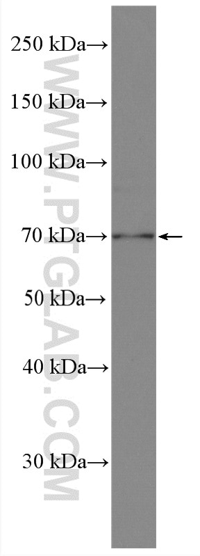 Western Blot (WB) analysis of mouse brain tissue using ZC3H14 Polyclonal antibody (28190-1-AP)