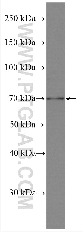 WB analysis of mouse brain using 28190-1-AP