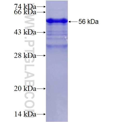 ZC3H14 fusion protein Ag28182 SDS-PAGE