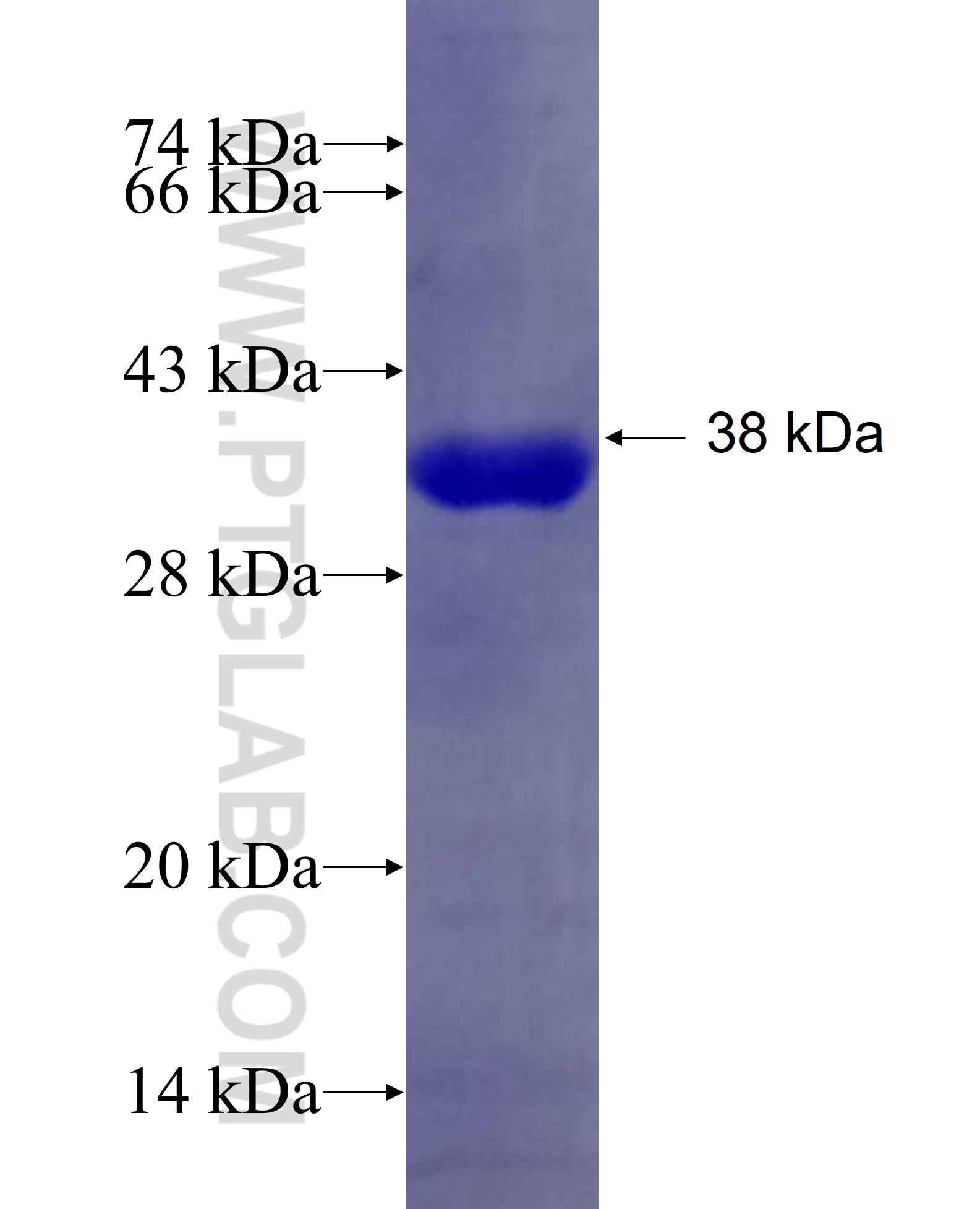 ZC3H14 fusion protein Ag28272 SDS-PAGE