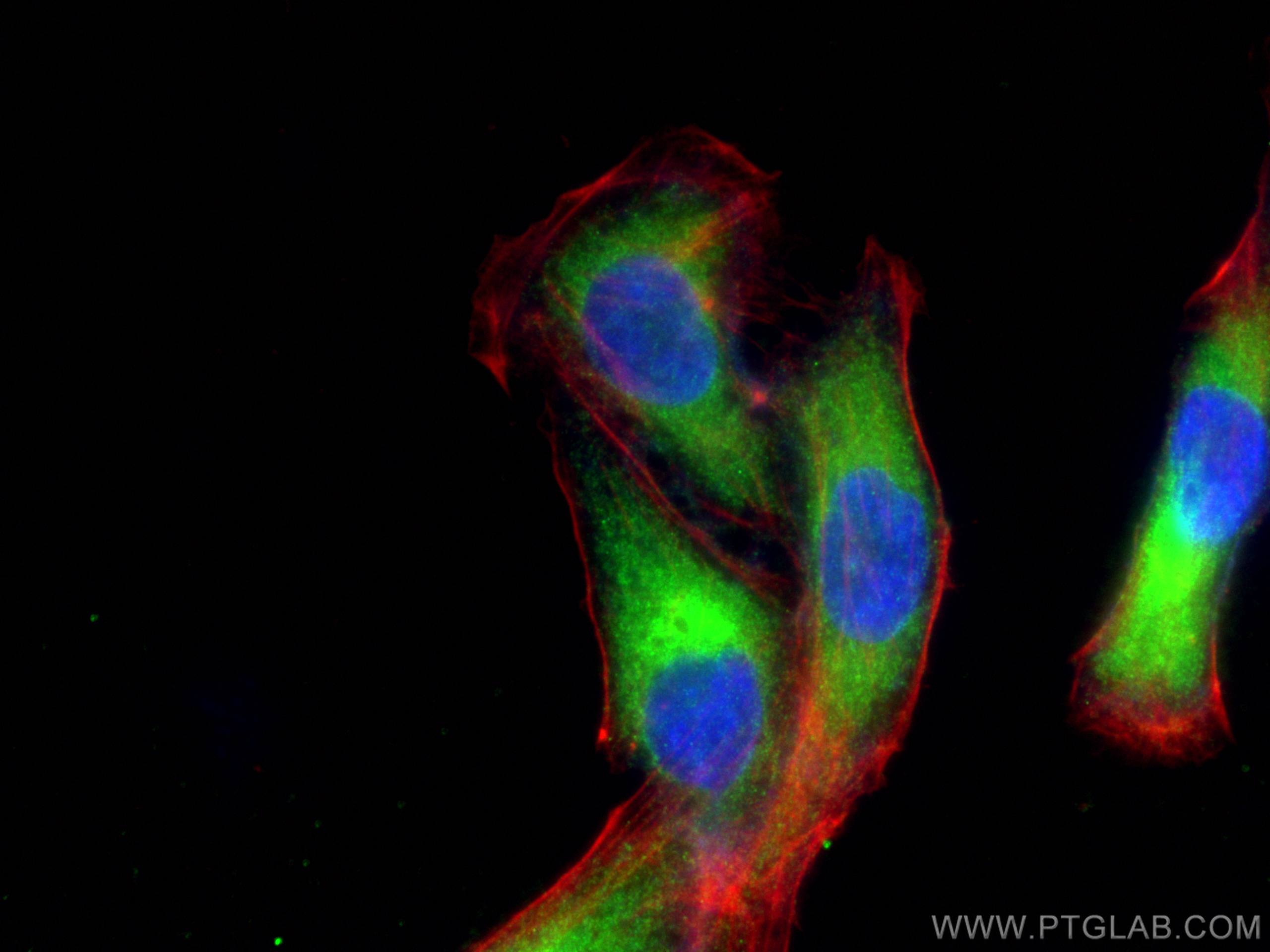 Immunofluorescence (IF) / fluorescent staining of U2OS cells using ZC3H15 Polyclonal antibody (26241-1-AP)