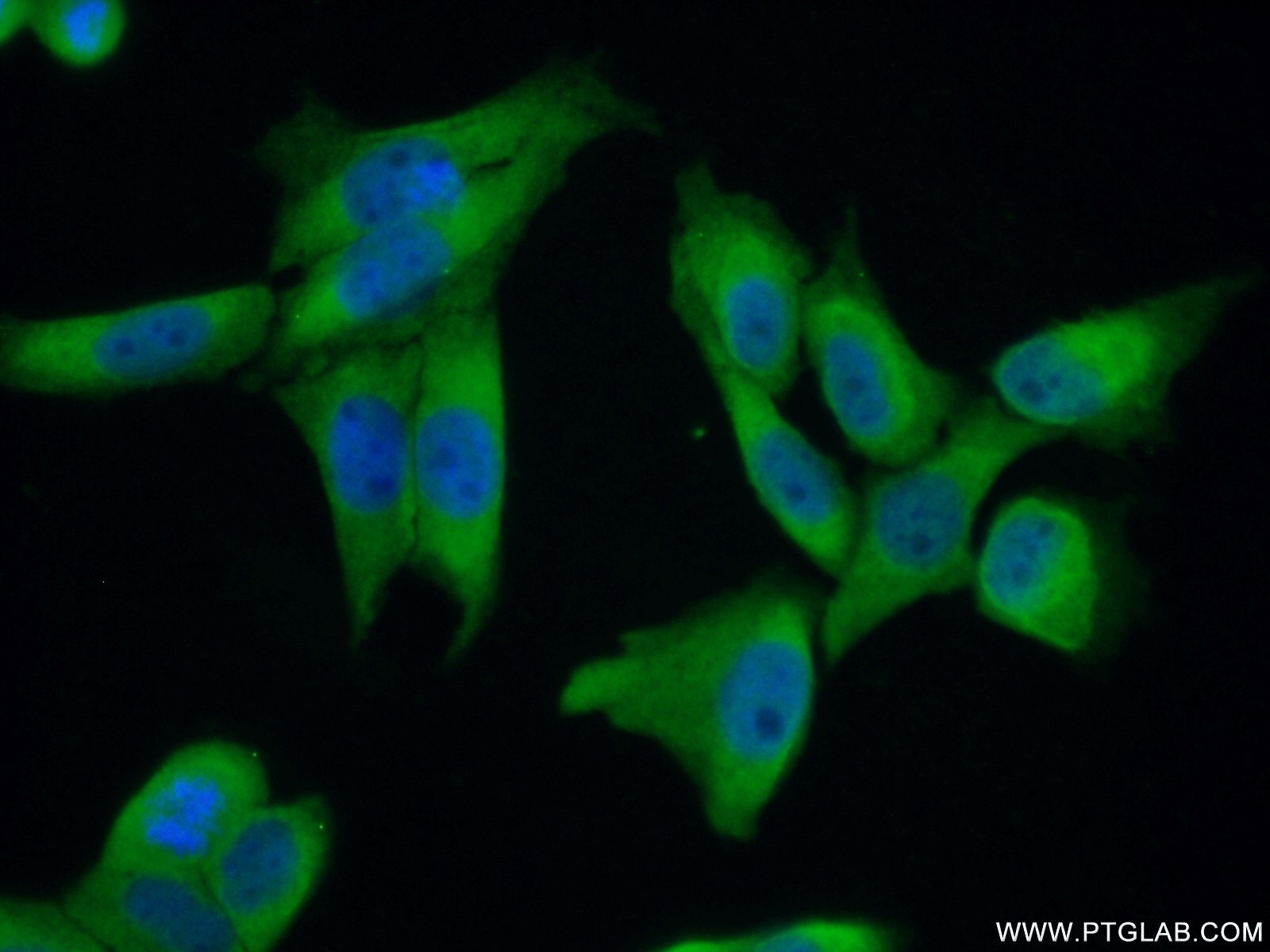 Immunofluorescence (IF) / fluorescent staining of HeLa cells using ZC3H15 Polyclonal antibody (26241-1-AP)
