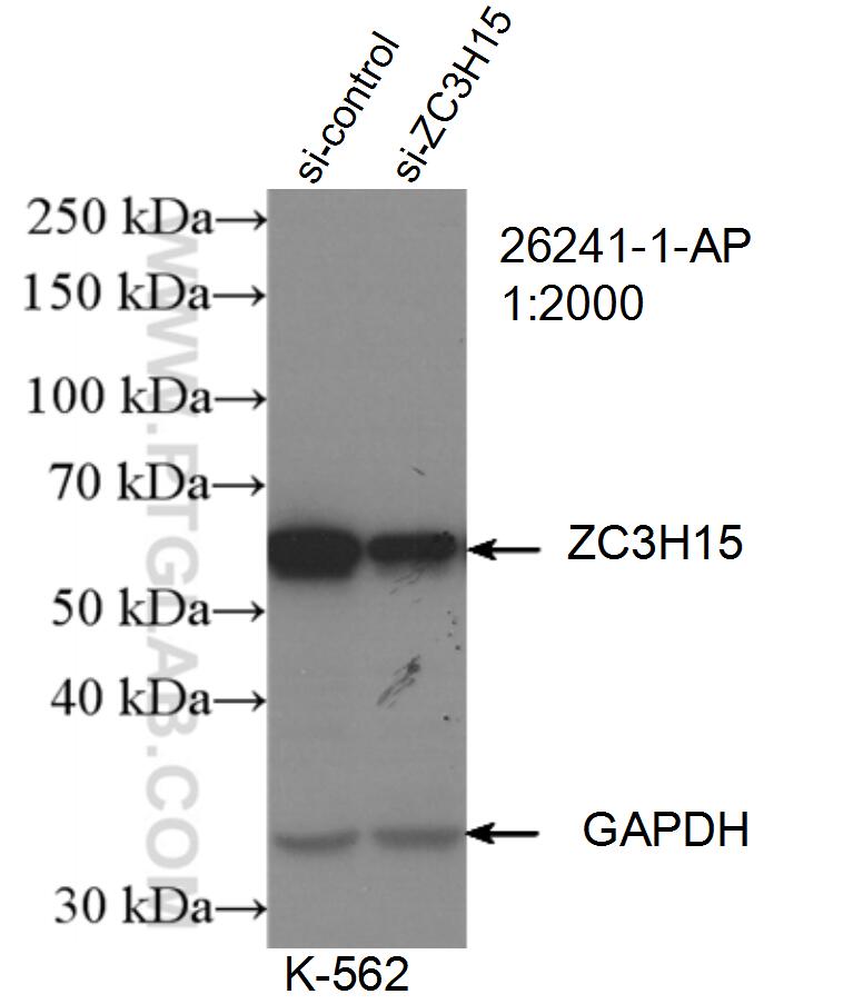 Western Blot (WB) analysis of K-562 cells using ZC3H15 Polyclonal antibody (26241-1-AP)