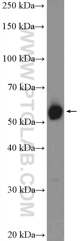 Western Blot (WB) analysis of HeLa cells using ZC3H15 Polyclonal antibody (26241-1-AP)