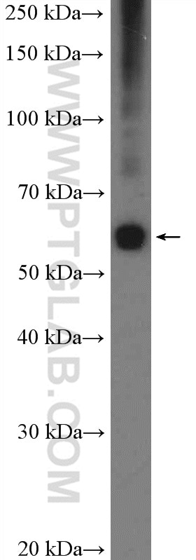 Western Blot (WB) analysis of HL-60 cells using ZC3H15 Polyclonal antibody (26241-1-AP)