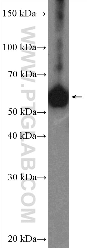 Western Blot (WB) analysis of K-562 cells using ZC3H15 Polyclonal antibody (26241-1-AP)