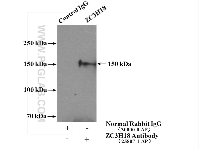 Immunoprecipitation (IP) experiment of HeLa cells using ZC3H18 Polyclonal antibody (25807-1-AP)