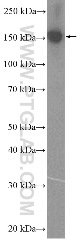 Western Blot (WB) analysis of HepG2 cells using ZC3H18 Polyclonal antibody (25807-1-AP)