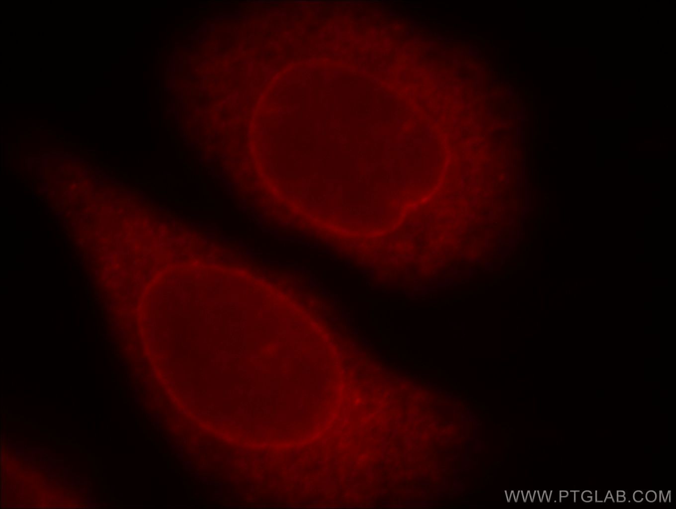 Immunofluorescence (IF) / fluorescent staining of HeLa cells using ZC3H4 Polyclonal antibody (20041-1-AP)