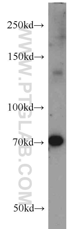 Western Blot (WB) analysis of human brain tissue using ZC3H4 Polyclonal antibody (20041-1-AP)