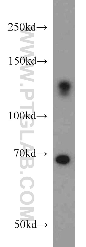 Western Blot (WB) analysis of mouse brain tissue using ZC3H4 Polyclonal antibody (20041-1-AP)