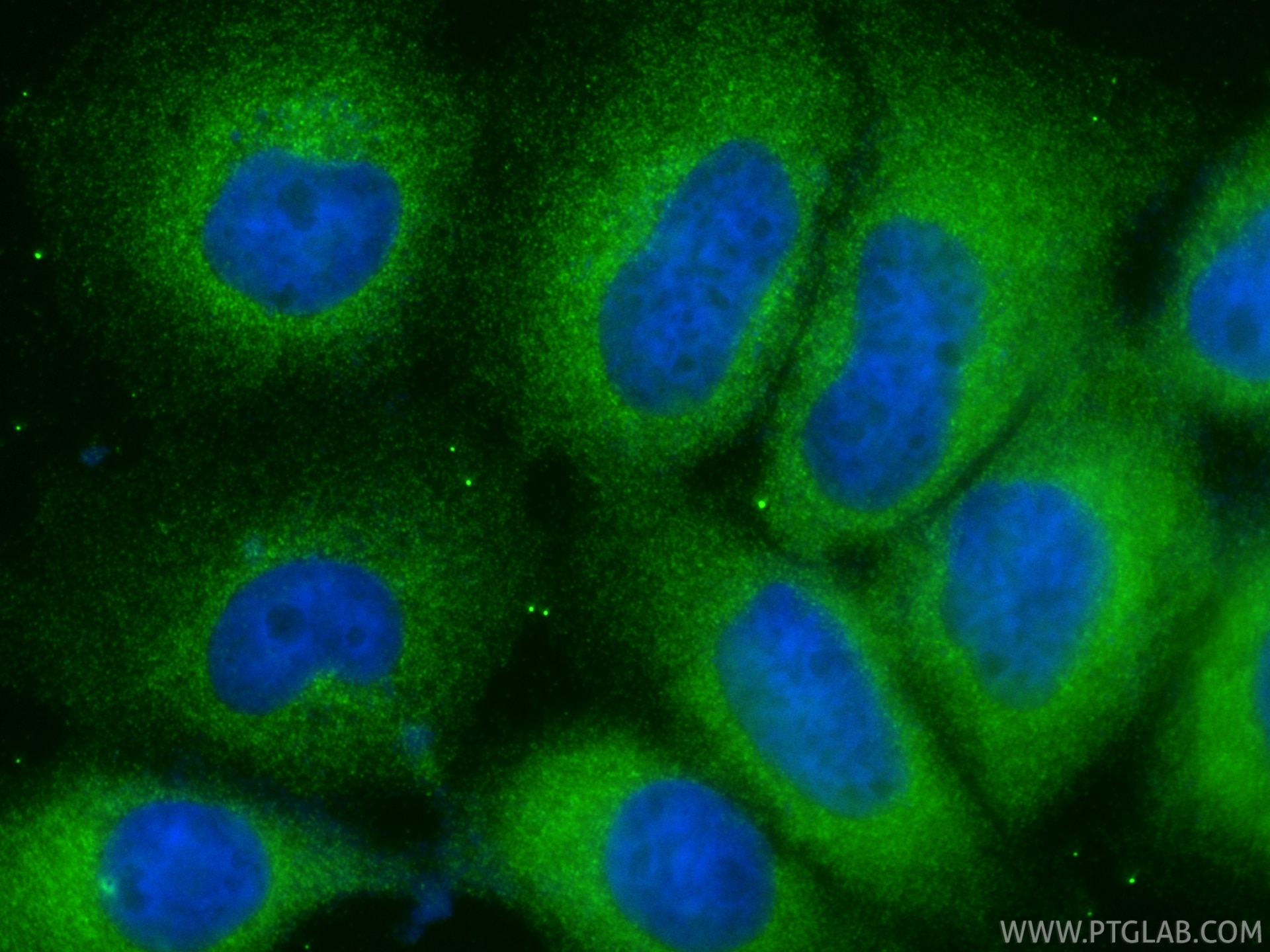 Immunofluorescence (IF) / fluorescent staining of A431 cells using ZC3H7A Polyclonal antibody (34174-1-AP)