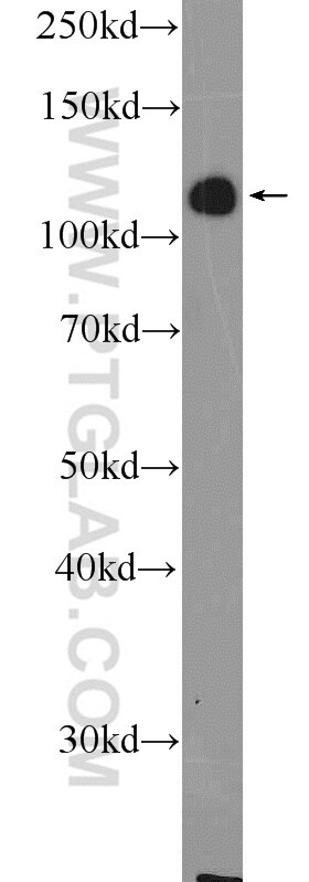 Western Blot (WB) analysis of mouse brain tissue using ZC3H7B Polyclonal antibody (25624-1-AP)