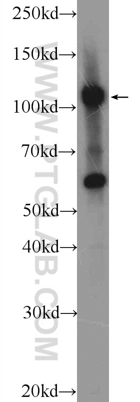 Western Blot (WB) analysis of HUVEC cells using ZC3H7B Polyclonal antibody (25624-1-AP)