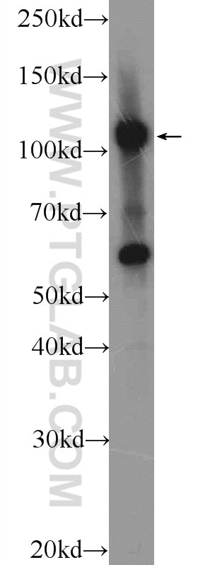 WB analysis of HUVEC using 25624-1-AP