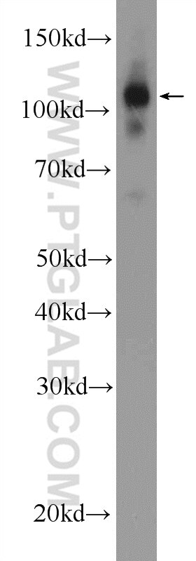 Western Blot (WB) analysis of mouse brain tissue using ZC3H7B Polyclonal antibody (25624-1-AP)