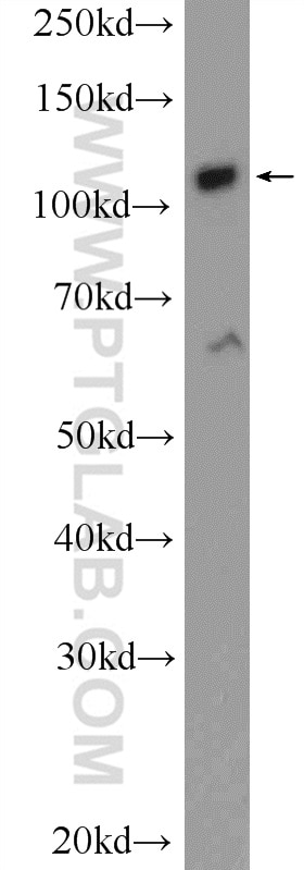 Western Blot (WB) analysis of HUVEC cells using ZC3H7B Polyclonal antibody (25624-1-AP)