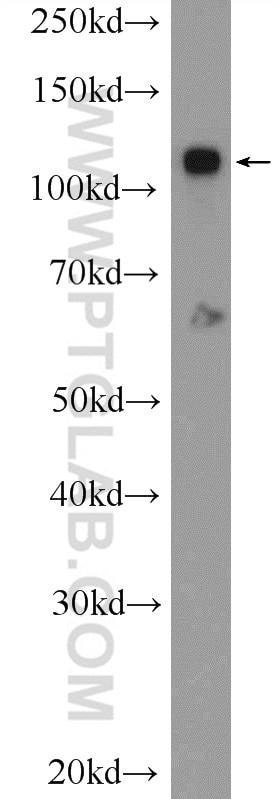 Western Blot (WB) analysis of HUVEC cells using ZC3H7B Polyclonal antibody (25624-1-AP)