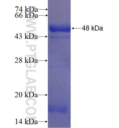 ZC3H7B fusion protein Ag22555 SDS-PAGE