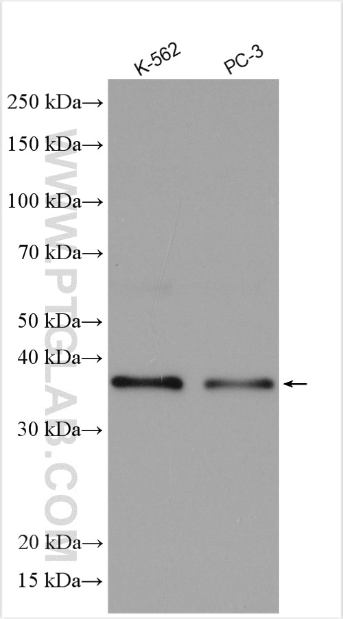 Western Blot (WB) analysis of various lysates using ZC3H8 Polyclonal antibody (26152-1-AP)