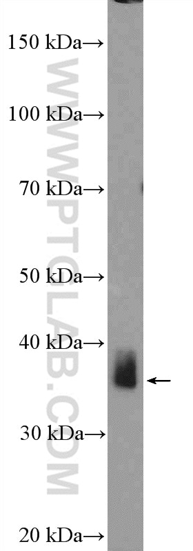 Western Blot (WB) analysis of PC-3 cells using ZC3H8 Polyclonal antibody (26152-1-AP)
