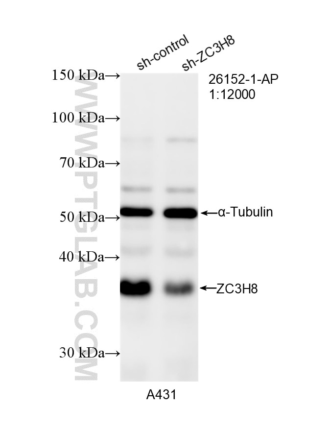 Western Blot (WB) analysis of A431 cells using ZC3H8 Polyclonal antibody (26152-1-AP)